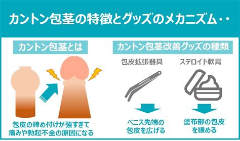 かせいほうけいとは|包茎とは？図で仮性・真性・嵌頓の見分け方をわかり。